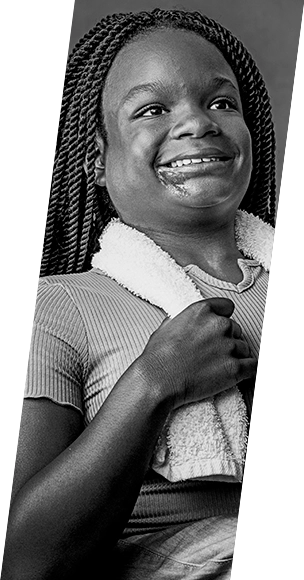 Mia vs Pediatric Chronic Sialorrhea