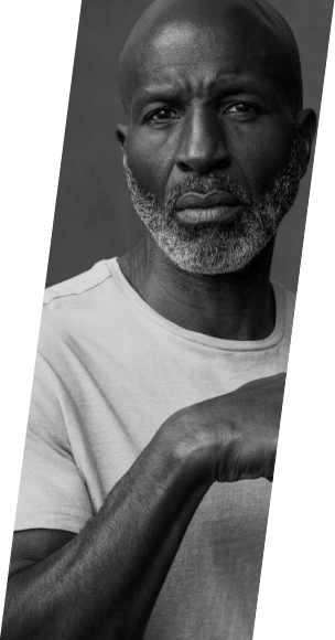 Russell vs Upper Limb Spasticity